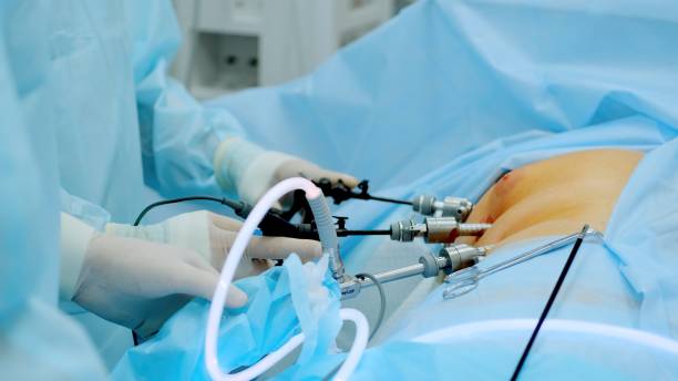 Best Laparoscopic Surgery Specialist in Kandivali