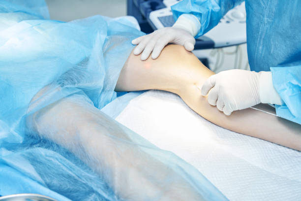 Best Varicose Vein Laser Surgery in Kandivali